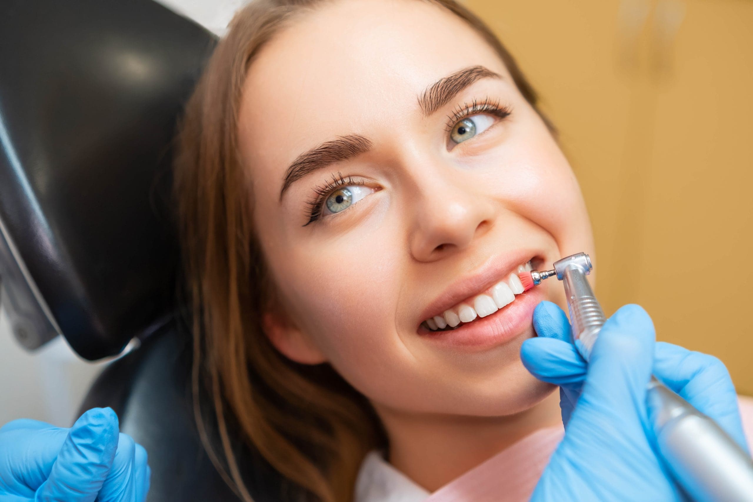 Dental Bridges on Front Teeth: Restoring Your Smile with Confidence